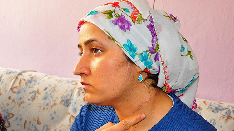 Eşi tarafından boğazı kesilen Esra Oymak: Hayatım karardı Eşi tarafından boğazı kesilen Esra Oymak: Hayatım karardı