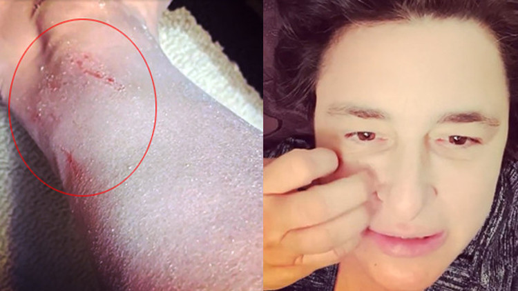 Esra Dermancıoğlu hastalığını açıkladı