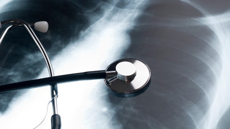 Sigarayı bırakmaya yardımcı 12 etkili öneri Sigarayı bırakmaya yardımcı 12 etkili öneri