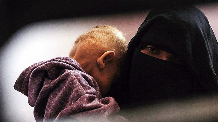 Dünya genelinde her 1 dakikada 11 insan açlıktan ölüyor Dünya genelinde her 1 dakikada 11 insan açlıktan ölüyor