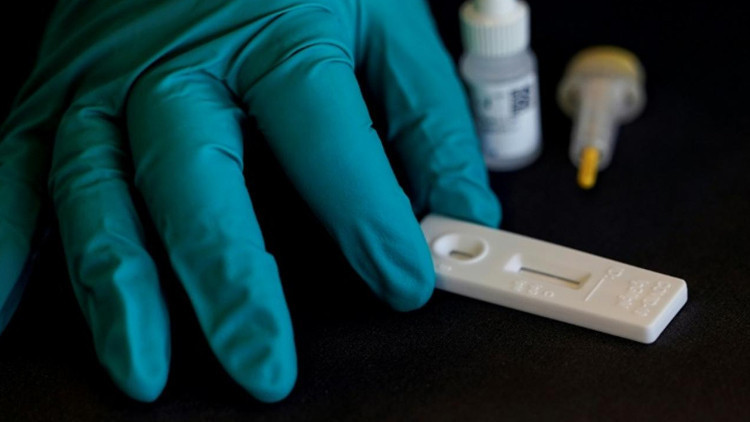 Yeni nesil testler yolda... Koronavirüs, grip ve nezleyi 30 dakikada tespit edecek Yeni nesil testler yolda... Koronavirüs, grip ve nezleyi 30 dakikada tespit edecek