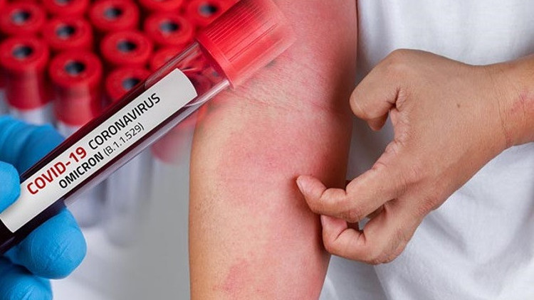 Omicrondan önce bu semptom yoktu Daha çok çocukları etkiliyor: El ve ayaklara dikkat