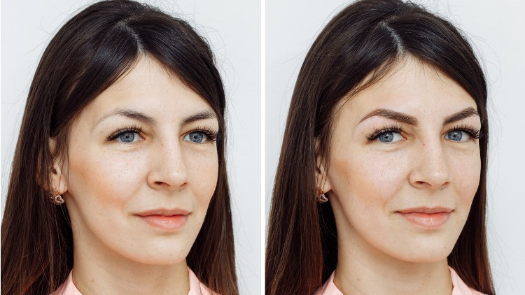 Kaş ve Kirpik Ekimi Nedir, Nasıl Uygulanır