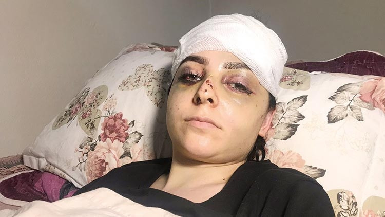 Tayt dayağı: Karısını öldüresiye döven cani serbest kaldı Tayt dayağı: Karısını öldüresiye döven cani serbest kaldı
