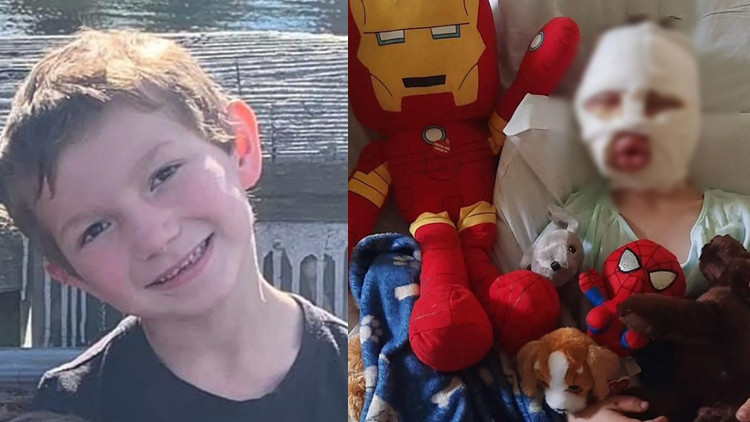 ABDde korkunç saldırı Tenis topunu ateşe verip küçük çocuğun yüzüne fırlattı... ABDde korkunç saldırı Tenis topunu ateşe verip küçük çocuğun yüzüne fırlattı...