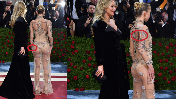 Hastalığını gizlemedi: Kırmızı halıya böyle çıktı Hastalığını gizlemedi: Kırmızı halıya böyle çıktı