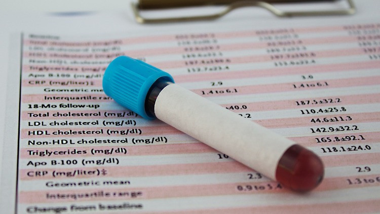 Hormon testi nasıl yapılır Hormon testi nasıl yapılır