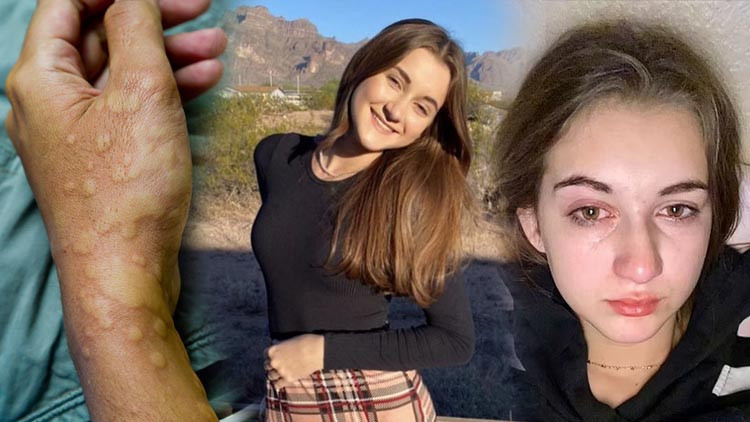 Dünyada 32 kişi bu hastalığı yaşıyor: Ağlamak bile yasak En son bir yıl önce su içtim