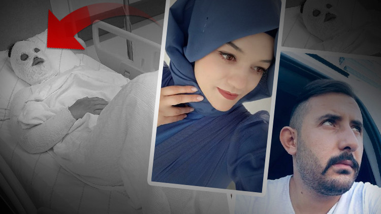 Konyada korkunç olay Su saatine bakacağız deyip yüzüne yanıcı madde attı Konyada korkunç olay Su saatine bakacağız deyip yüzüne yanıcı madde attı