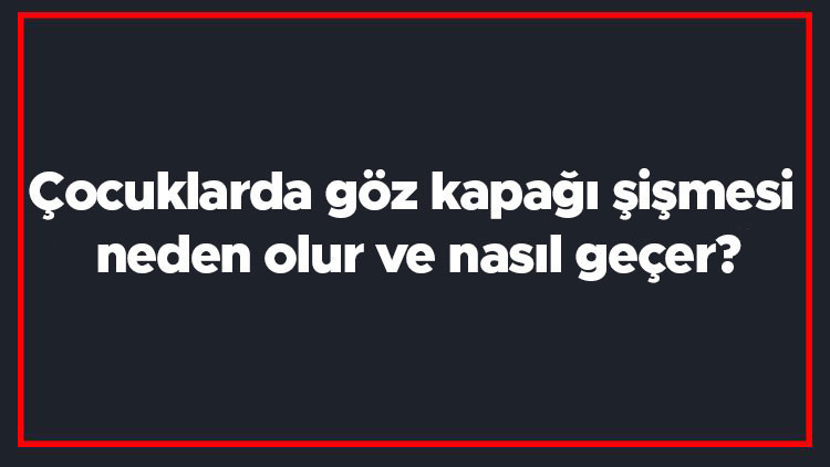Çocuklarda göz kapağı şişmesi neden olur ve nasıl geçer Çocukta göz kapağı şişmesi nasıl tedavi edilir
