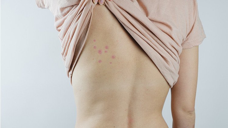 Dünyanın en ölümcül canlısı Sivrisineklerin sırrını bilim insanları çözdü