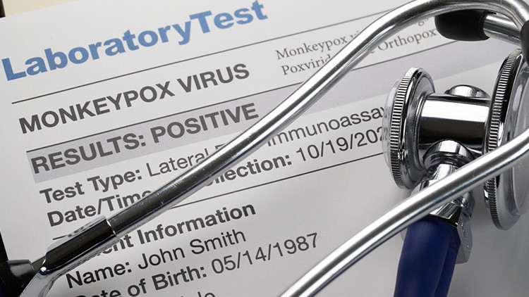 Maymun Çiçeğinde korkutan senaryo: Çok geç kalmış olabiliriz...