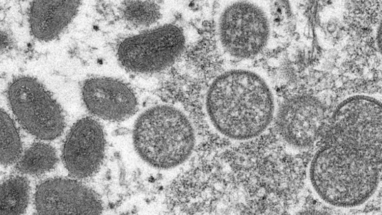 DSÖ:Maymun çiçeği virüsü maymunlarla bağlantılı değil DSÖ:Maymun çiçeği virüsü maymunlarla bağlantılı değil