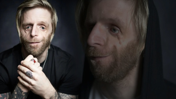 Ailesi görünüşü nedeni ile doğduktan 36 saat sonra terk etti Bir kız beni öptükten sonra hayatım değişti