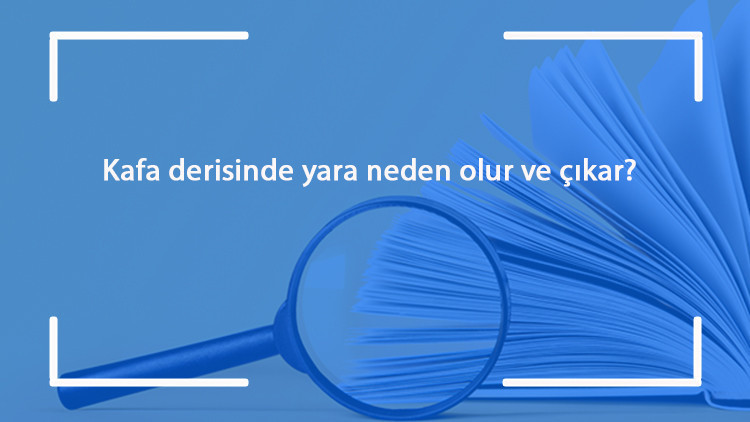 Kafa derisinde yara neden olur ve çıkar Kafa derisindeki yara nasıl geçer Kafa derisinde yara neden olur ve çıkar Kafa derisindeki yara nasıl geçer