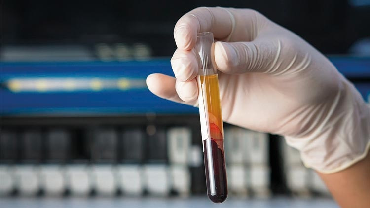 Kanser avcısı kan testi Kanser avcısı kan testi