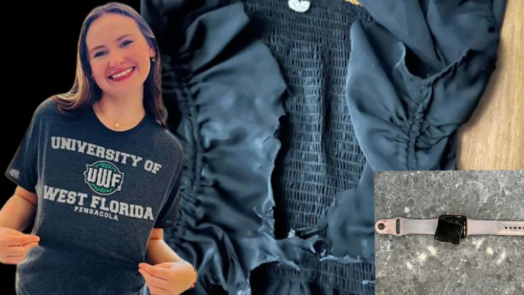 Okulun ilk gününde göğsüne yıldırım düştü Kıyafetleri erdi, saati patladı