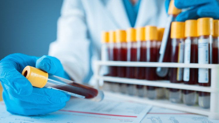 Kan tahlili aç karnına mı yapılır, öncesinde su içilir mi Kan tahlili için kaç saat aç kalmak gerekir Tahlil yaptırmadan önce bunlara dikkat Kan tahlili aç karnına mı yapılır, öncesinde su içilir mi Kan tahlili için kaç saat aç kalmak gerekir Tahlil yaptırmadan önce bunlara dikkat