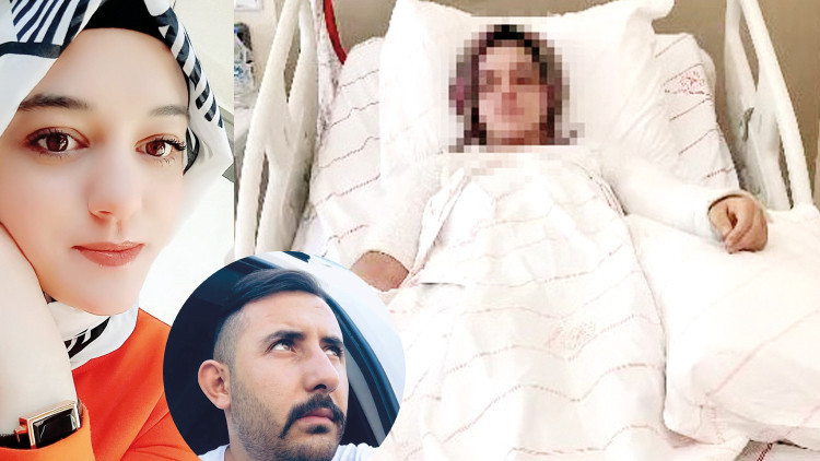 Eski nişanlısının yüzüne kimyasal atmıştı... Caninin savunması: ‘Susturmak için attım’ Eski nişanlısının yüzüne kimyasal atmıştı... Caninin savunması: ‘Susturmak için attım’
