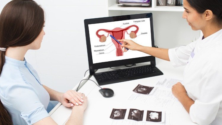 Her 4 kadından 1’inde görülüyor Rahim miyomları hakkında bilinmesi gereken 5 önemli nokta Her 4 kadından 1’inde görülüyor Rahim miyomları hakkında bilinmesi gereken 5 önemli nokta