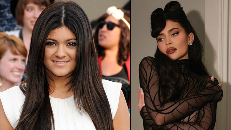 10 yıl önceki halini gören tanıyamıyor… Kylie Jenner estetik tartışmasını yeniden açtı: Yüzüm estetiksiz, her zaman çok güzeldim
