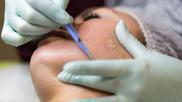 YENİ MODA DERMAPLANING | Bebek gibi cildim olsun derken hata yapmayın, işi uzmanına bırakın YENİ MODA DERMAPLANING | Bebek gibi cildim olsun derken hata yapmayın, işi uzmanına bırakın