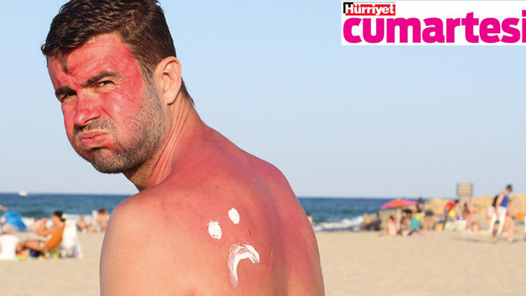 Güneş yanıklarına teslim olmayın