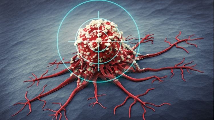Yapay zekâ, elektronik sütyen, hedefli kemoterapi hapı… Sonunda kanser tarih mi oluyor I 1 SORU 6 UZMAN
