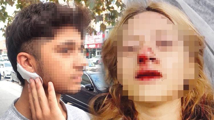 Bunları yapan çocuk Yüzüne kaldırım taşı attılar, kulağını yardılar