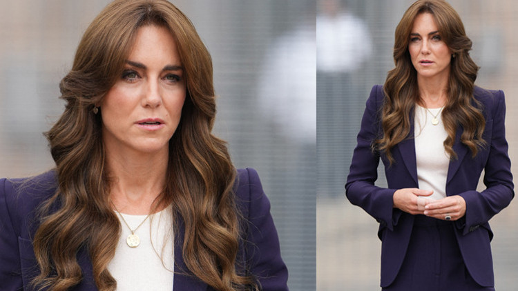 Herkes saçlarına bakıyordu ama... Kate fena düşmüş