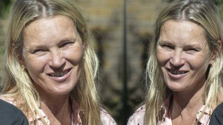 Som altından heykeli bile yapılmıştı... Yaşadığı hızlı hayat güzelliğini aldı: Efsaneler de çöker