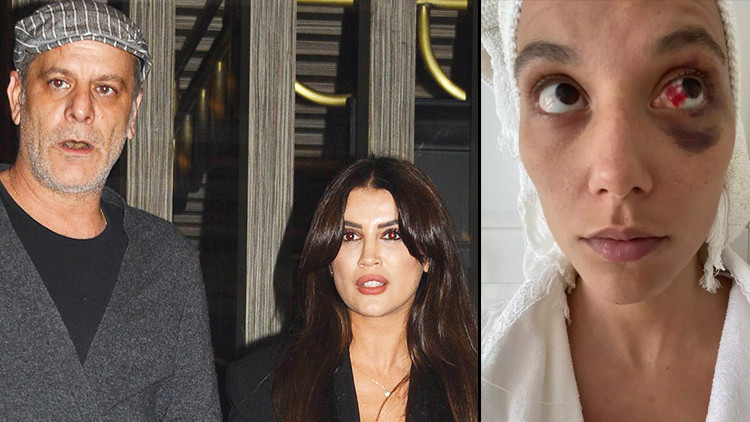 Ozan Güven günler sonra görüntülendi: Evden çıkmıyorum