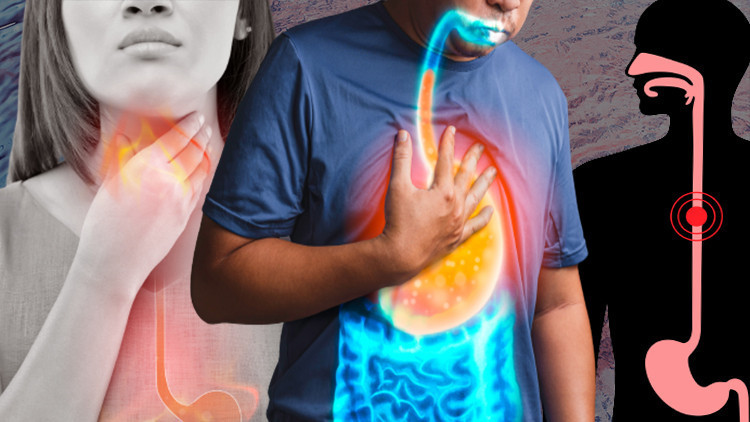 ‘Sessiz reflü’ sinsice ilerliyor Çok fazla çay ve kahve içenler dikkat ‘Ne hastaların ne de hekimlerin aklına geliyor’ ‘Sessiz reflü’ sinsice ilerliyor Çok fazla çay ve kahve içenler dikkat ‘Ne hastaların ne de hekimlerin aklına geliyor’