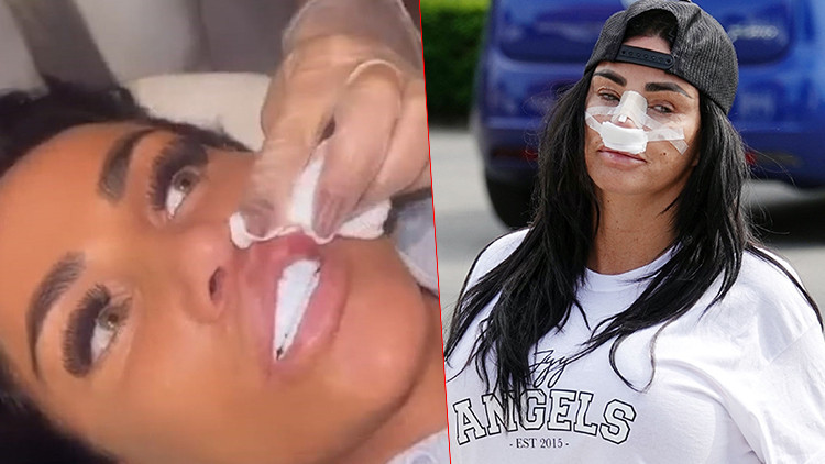 Estetik bağımlısı ünlü isim kendini durduramıyor... Bu uğurda iflas etti ama yine doktorun yolunu tuttu Estetik bağımlısı ünlü isim kendini durduramıyor... Bu uğurda iflas etti ama yine doktorun yolunu tuttu