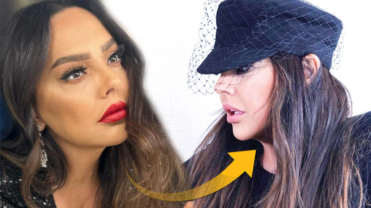 Yüzündeki değişim dikkat çekti... İşte yeni Ebru