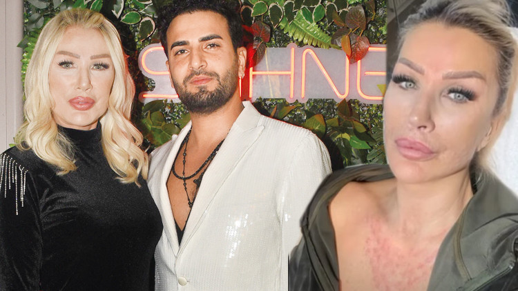 Seda Sayandan estetik açıklaması