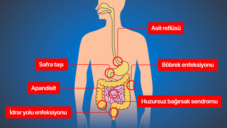 Karın ağrınızın yeri ne anlama geliyor İşte detay detay ağrı bölgeleri ve işaret ettikleri hastalıklar... Karın ağrınızın yeri ne anlama geliyor İşte detay detay ağrı bölgeleri ve işaret ettikleri hastalıklar...