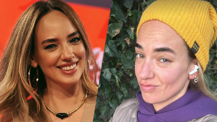 En doğal halini paylaştı... Sıfır makyaj Seda