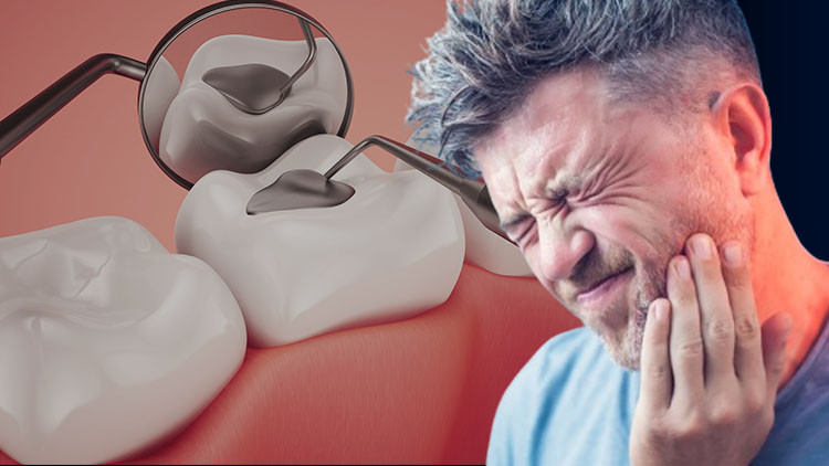 Avrupada amalgam dolgu neden yasaklandı Türkiye’de kullanımı azaldı ama sürüyor... Sağlığa ne gibi zararları bulunuyor Avrupada amalgam dolgu neden yasaklandı Türkiye’de kullanımı azaldı ama sürüyor... Sağlığa ne gibi zararları bulunuyor