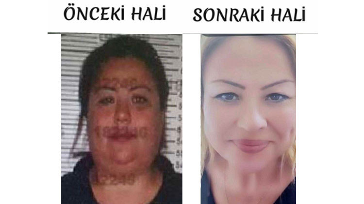 Bu da kardeş yüzlü dolandırıcı: Yaptığı estetik şoke etti