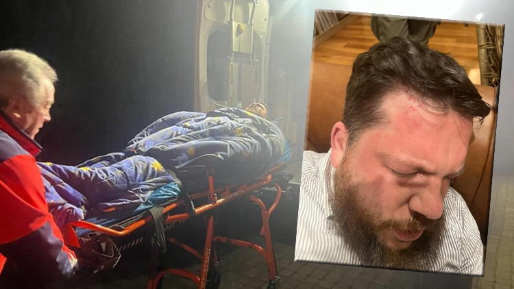 Navalninin yardımcısına çekiçli saldırı