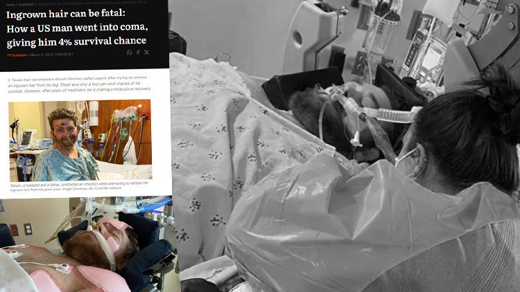 Bacağındaki kılları almaya çalışırken canından oluyordu Günlerce komada kaldı, doktorlar yaşaması için yüzde 4 şans verdi Bacağındaki kılları almaya çalışırken canından oluyordu Günlerce komada kaldı, doktorlar yaşaması için yüzde 4 şans verdi