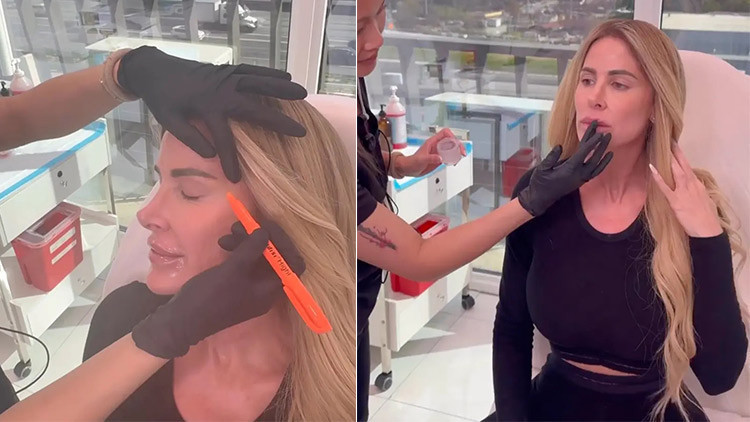 Ünlü çift parasızlıktan boşanamıyordu… Gırtlağına kadar borç içinde ama botoks ve dolgu yaptırmayı ihmal etmedi