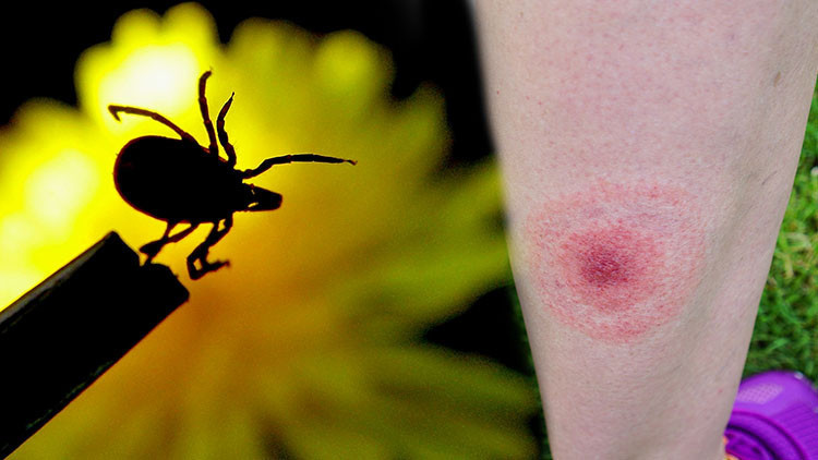 ‘Büyük taklitçi’ olarak bilinen hastalıkta umut veren gelişme İnsan terinde bulunan protein sonu olabilir… ‘Krem, ilaç ya da aşı üretilebilir’