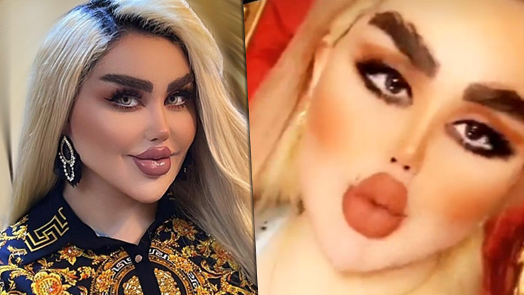 Iraklı Barbie 43 estetik ameliyat geçirdi, insanlar zombiye benzediğini söylüyor