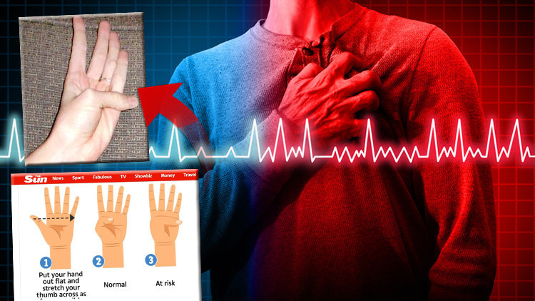 Sosyal medyayı paniğe sürükleyen video: Basit bir başparmak testi, ölümcül hastalığı ortaya çıkarabilir Doktorlardan peş peşe açıklama...