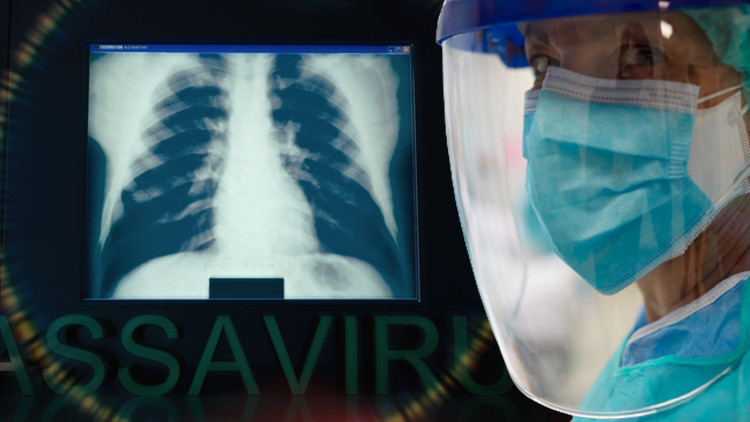 Gözlerde ve kulaklarda kanamaya neden olan virüs Fransada Yetkililer temaslı kişilerin peşine düştü