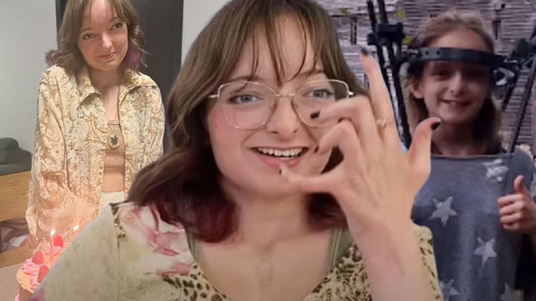 Hastalık vücudunu eritiyor Daha 20’sinde ama 75 yaşında gibi hissediyor… ‘Fiziğim korkunç şekilde değişti, organlarım her an patlayabilir’