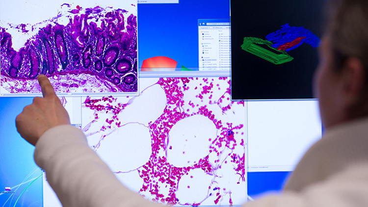 Bilim insanları kolon kanserinde aile faktörüne dikkat çekiyor Bilim insanları kolon kanserinde aile faktörüne dikkat çekiyor
