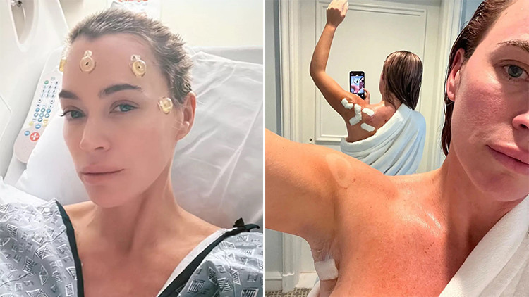 Ünlü oyuncunun bitmeyen kâbusu… Cilt kanserini yendim derken beyninde tümör bulundu